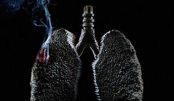 Una mutación genética aumenta el riesgo de cáncer de pulmón 