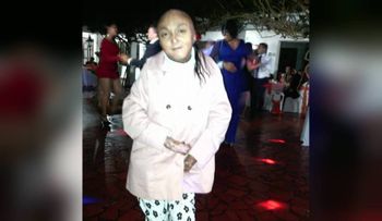 Muere Jessica Ramírez, la joven colombiana con piel de mariposa