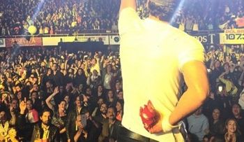 Enrique Iglesias se recupera de cortadura en México 