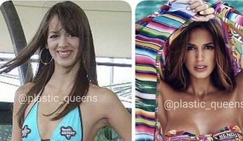 Las redes se encienden con cambio facial de Shannon de Lima, la novia de Canelo y ex de Marc Anthony