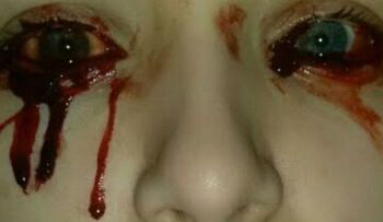 El extraño caso de la niña que llora sangre