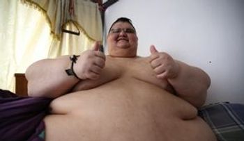 El hombre más obeso del mundo se prepara para operación tranquilo y motivado