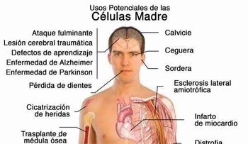 Video: Terapia con células madres: esperanzas y mentiras
