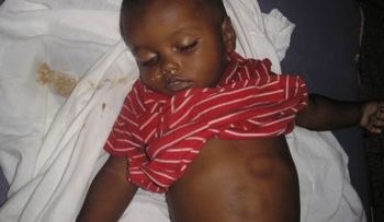 Imponen tres meses como medida coerción a hijo que mató a golpes a su padre 