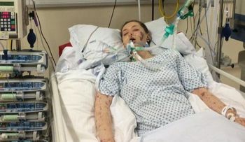 FOTOS MUY FUERTES: Una joven muestra crudas imágenes para crear conciencia sobre su enfermedad