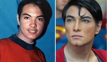 Joven se hace 19 cirugías para parecerse a Superman
