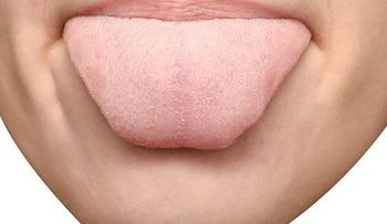 La lengua es un mapa de nuestro estado de salud