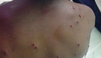 Juez libera agresor de estudiante fue impactada con perdigones