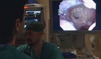 Hallan relación entre la grasa y el cáncer