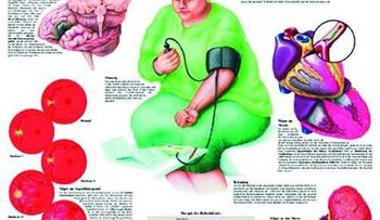 Principales causas de hipertensión arterial secundaria en ancianos