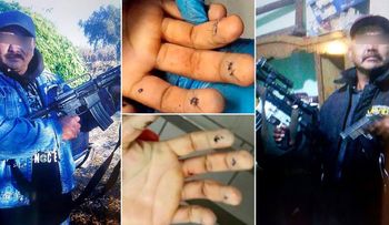 Asesinan capo mexicano "El Kalimba, mientras se sometía a una cirugía estética 
