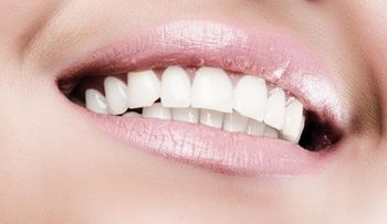 Remedios caseros efectivos para blanquear los dientes; No 1, 2, 3 y 4
