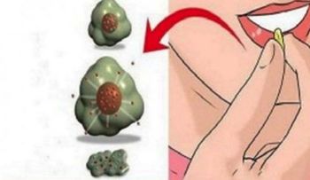 Alimentos que matan el cáncer; es hora de empezar a comerlos