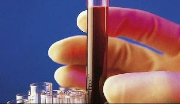 Detectar varios tipos de cáncer con una sola muestra de sangre