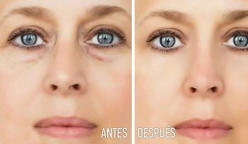 7 consejos para eliminar las bolsas bajo los ojos. ¡Un nuevo look te espera!