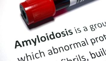 La amiloidosis sistémica (AS) es un trastorno de las proteínas que conduce a la disfunción orgánica