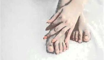 Hongos en las uñas de los pies y manos - Onicomicosis tratamiento natural