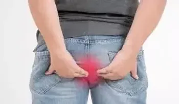 Imperdibles consejos para prevenir y tratar las hemorroides 