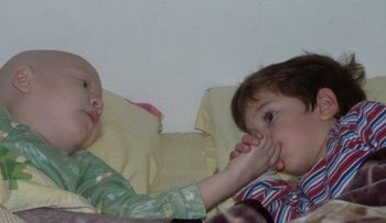 Una prometedora esperanza para los niños que sufren de leucemia agresiva