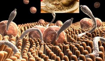 Como eliminar las amebas y otros parásitos de tu CUERPO