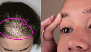 Este aceite es genial para el engrosamiento del cabello, pestañas y cejas
