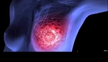 Algo que consumimos a diario esta causando cáncer de seno (VIDEO)