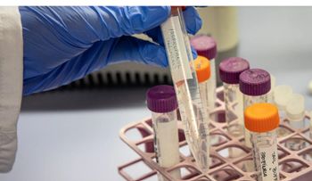 Desarrollan terapia génica para prevenir el alzhéimer