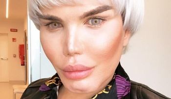 El "Ken Humano" parece una doña marciana, tras su última cirugía plástica