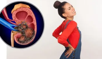 Pacientes con cáncer de vejiga y riñón, tendrían esperanza de vida con inmunoterapia 