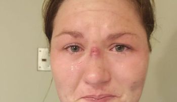 El dramático relato de una enfermera de una sala de intensivos donde nadie sobrevivió del coronavirus