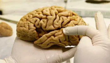 Ventajas y desventajas de los cerebros de las personas creativas, según la ciencia