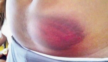 Envían a la cárcel Policías por torturas a presos en Los Alcarrizos 