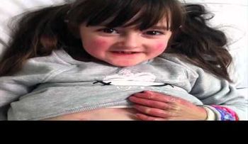 Una niña tiene alas de mariposa por una extraña enfermedad (VIDEO)