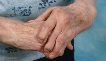 Artritis Psoriásica: Enfermedad de la piel que afecta articulaciones