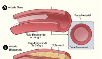 La importancia de bajar el colesterol
