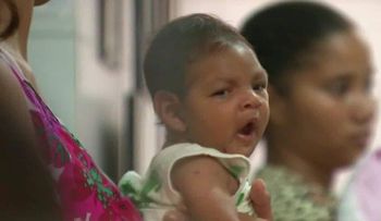 CDC: Virus del Zika definitivamente causa defectos de nacimiento