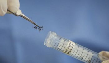 Desarrollar una vacuna contra el zika podría tomar varios años