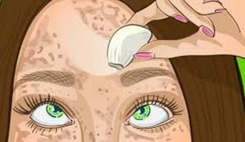 El remedio para la piel perfecta que borra las manchas como una goma (en hombres y mujeres)