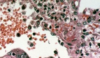 Un virus que no tiene cura ha causado decenas de muertos 