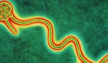 6 formas en las el ébola sí se contagia