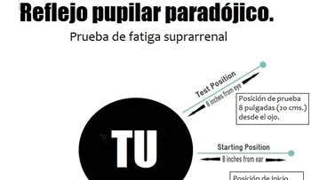  La causa real de la fatiga adrenal no es lo que piensas 