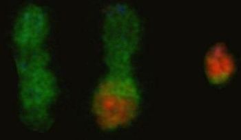 Reproducen en células humanas modificaciones cromosómicas propias del cáncer