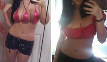Mujer se somete a cirugía para tener tres senos