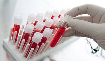 Potencial prueba de sangre para detectar cualquier tipo de cáncer