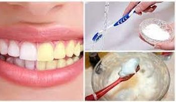 Imperdible receta para eliminar el sarro y blanquear tus dientes
