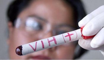  Una mayor cantidad de casos VIH en menores de 30 años, por poco uso de preservativos
