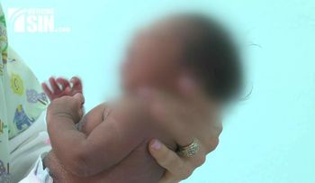 Costa Rica confirma el primer caso de microcefalia por zika