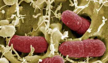 Descubren un supermicrobio resistente a antibióticos muy potentes