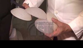  Riesgos de los implantes de senos y de glúteos 