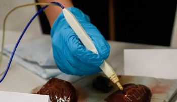 Científicos crean máquina capaz de "olerâ? el cáncer